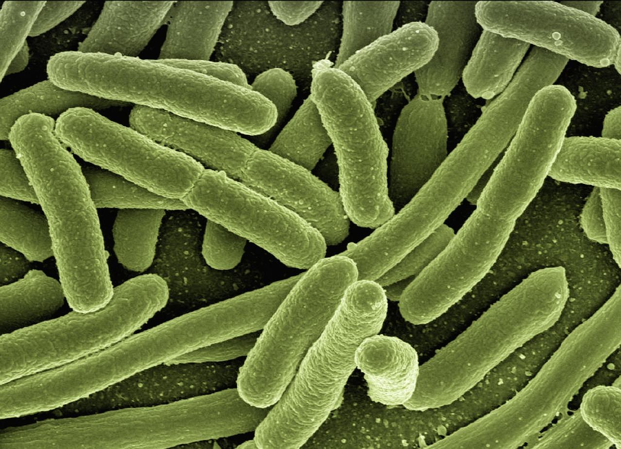 Escherichia Coli fromage